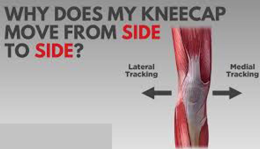knee instability